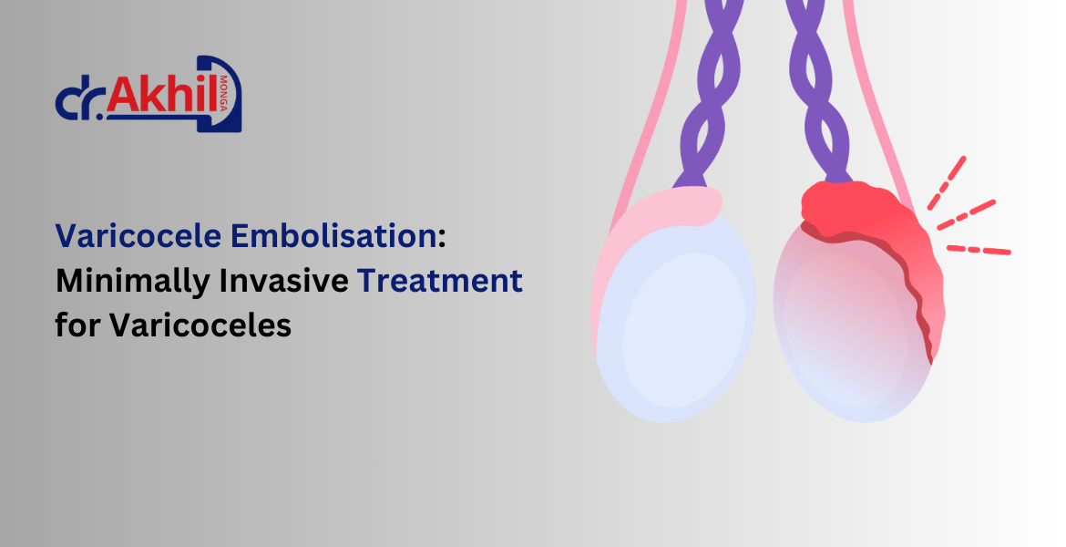 varicocele-embolisation-minimally-invasive-treatment-for-varicoceles