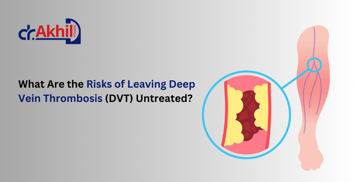 risk-of-leaving-deep-vein-thrombosis-untreated